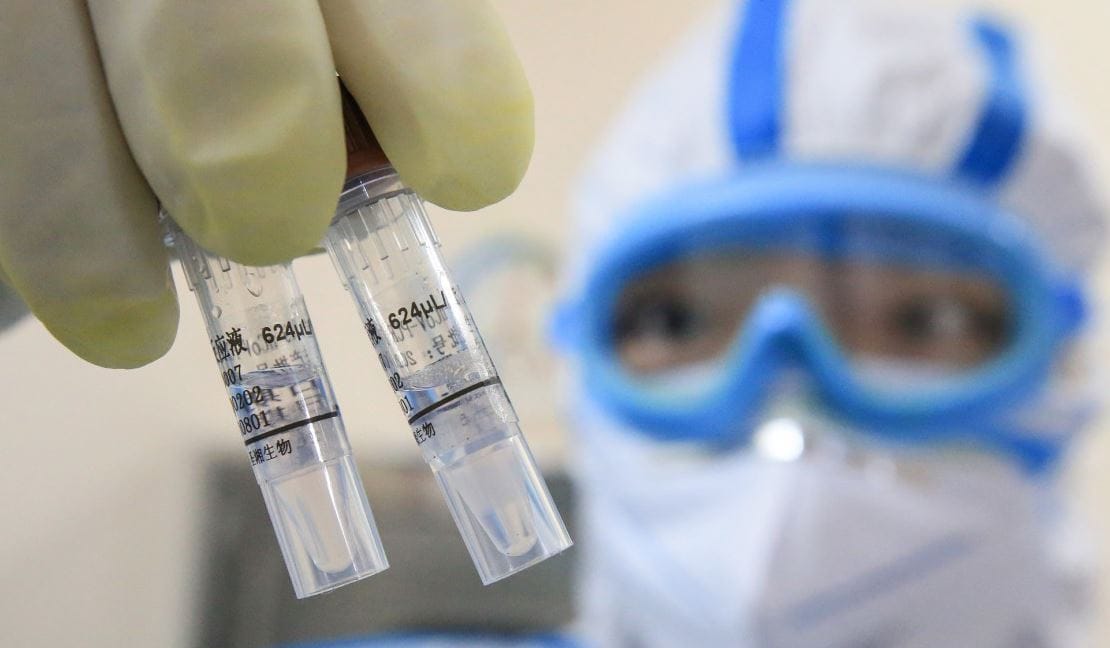HKU5: faut-il craindre le nouveau coronavirus identifié à Wuhan?