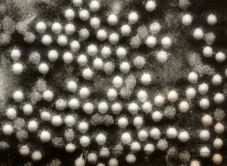 Vers une épidémie de polio en Ukraine ?