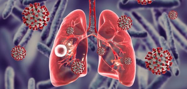 S’inspirer des stratégies anti- Covid pour mieux traiter la tuberculose