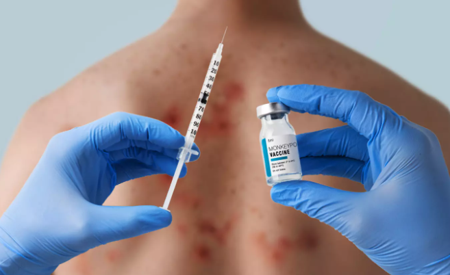 Vaccin  ARNm contre la variole du singe : Moderna vise un schéma proche des injections Covid