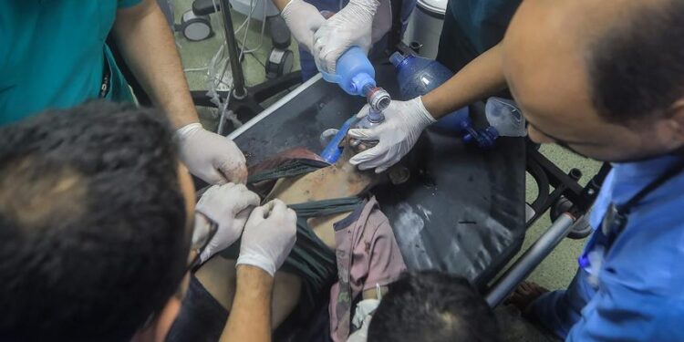 Meyssan : “Un tiers des amputations sans anesthésie à Gaza se fait sur des enfants”